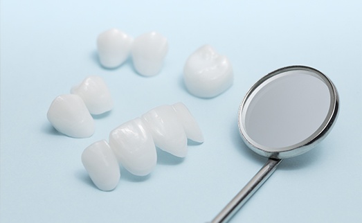 Dental restorations
